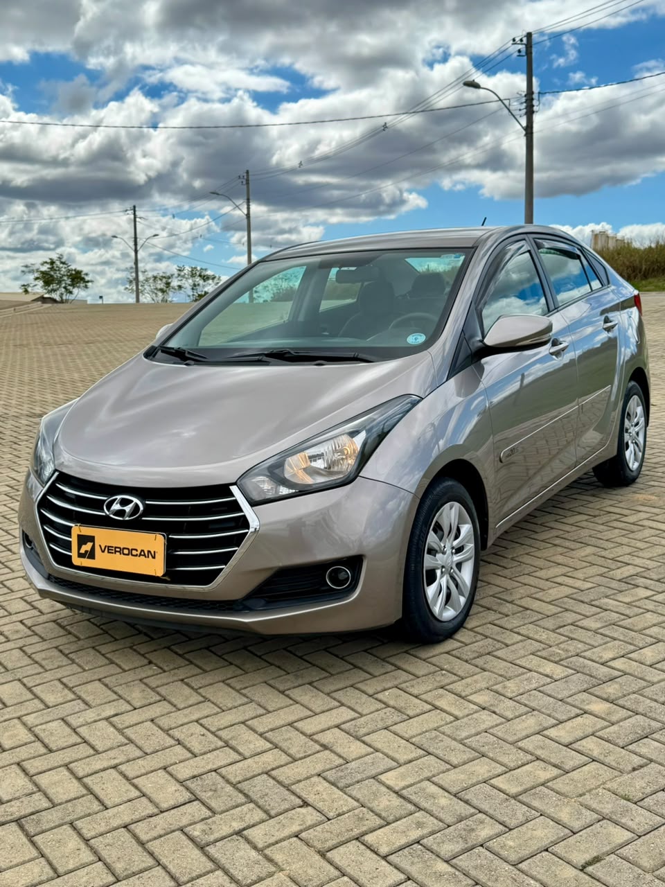 Hyundai HB20S
